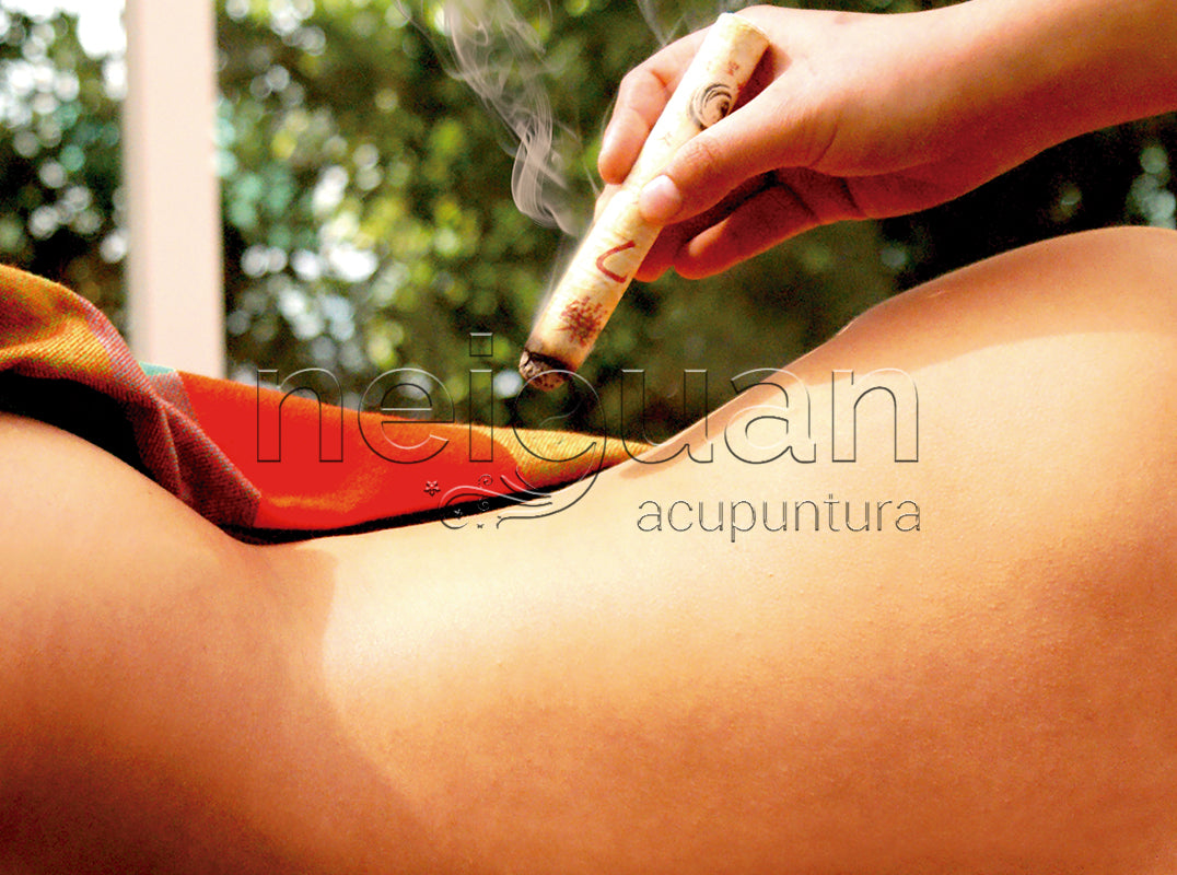 moxibustion- neiguan acupuntura