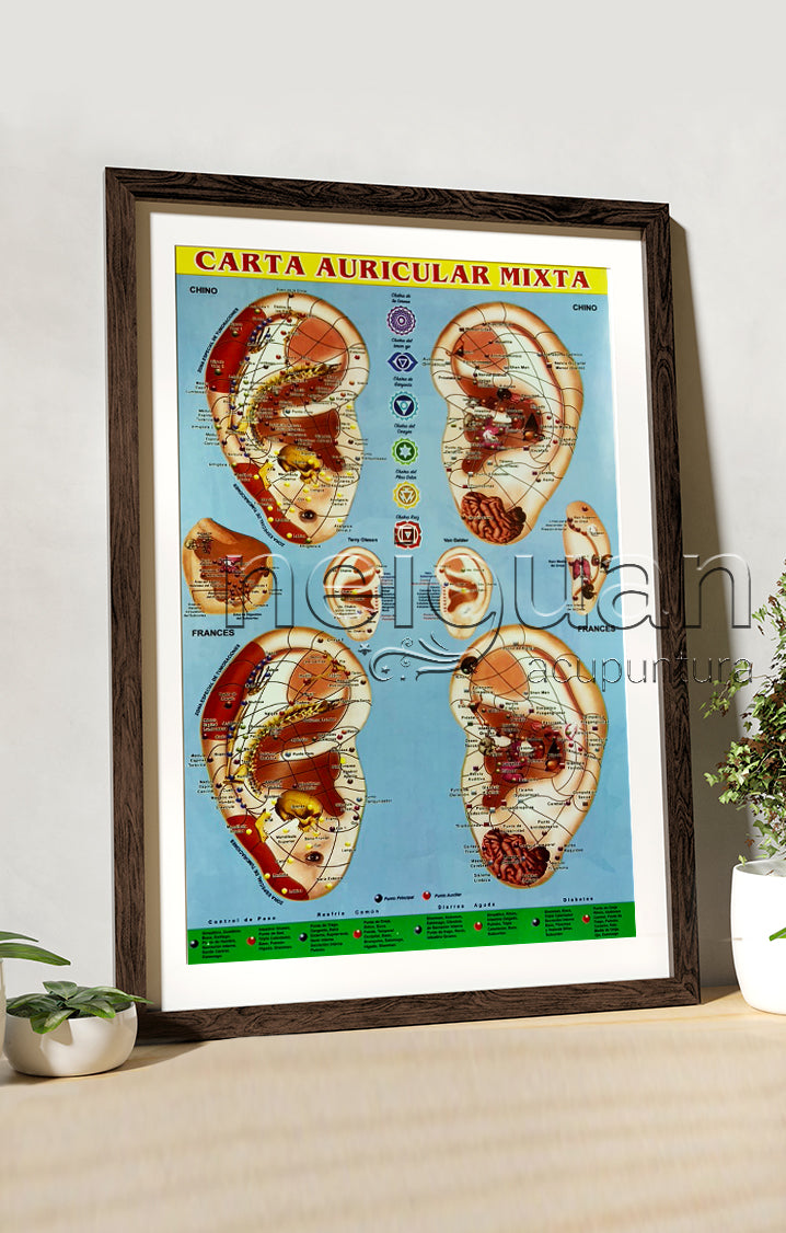 Neiguan Material de Acupuntura; Material para acupuntura; material de acupuntura, Acupuntura; Neiguan