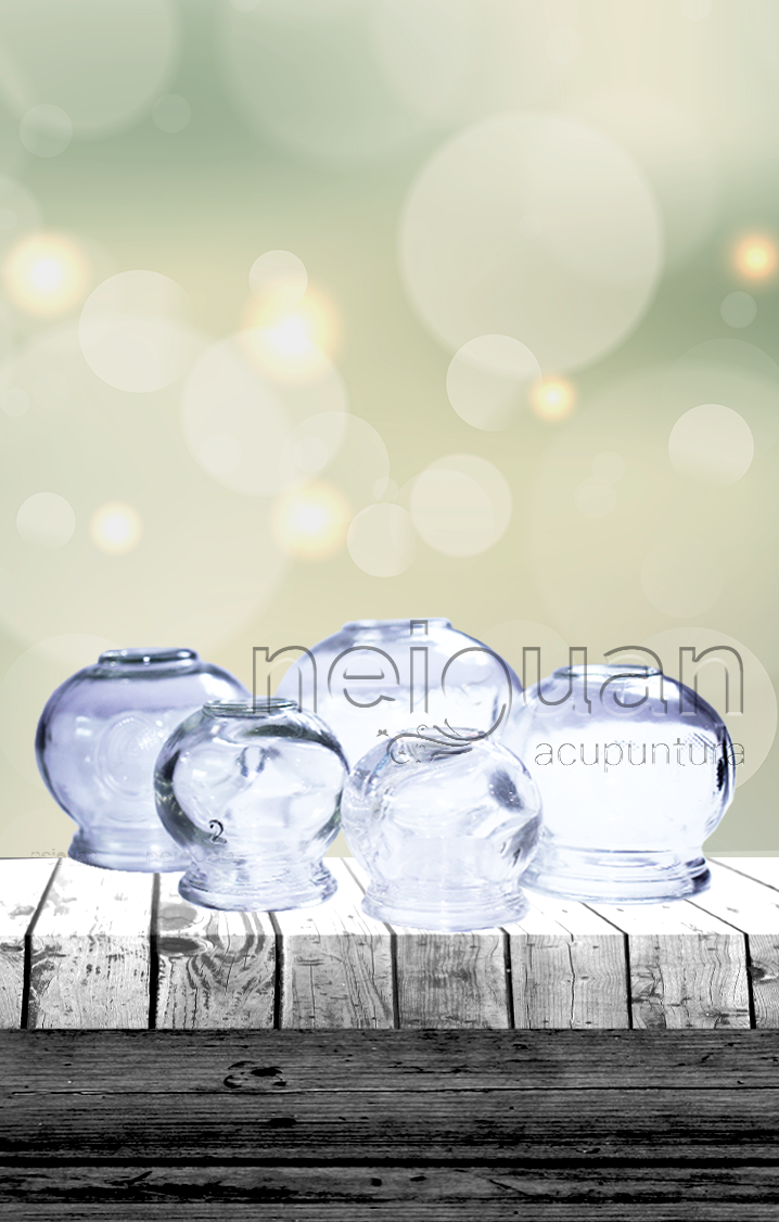 Neiguan Material de Acupuntura; Material para acupuntura; material de acupuntura, Acupuntura; Neiguan