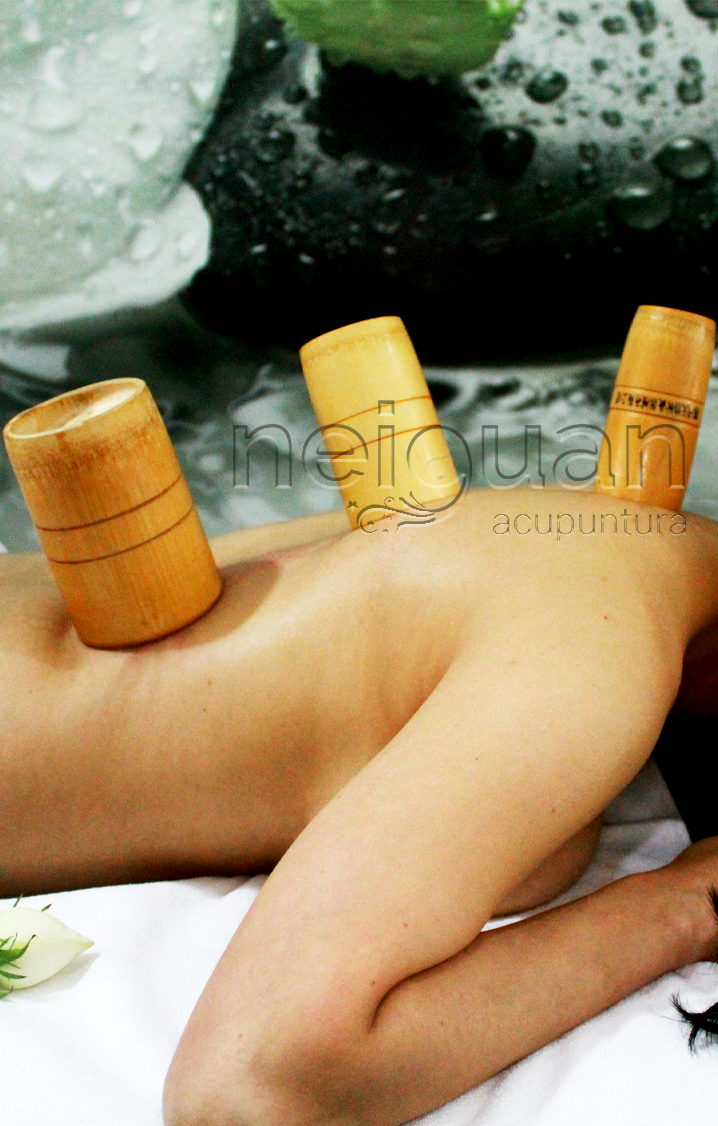 Neiguan Material de Acupuntura; Material para acupuntura; material de acupuntura, Acupuntura; Neiguan